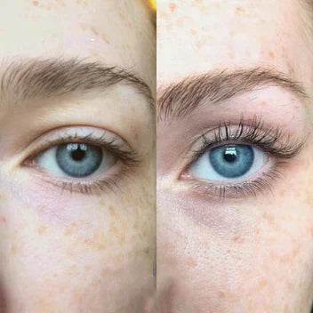 GLAMSKIT™ Eyelash Active Serum For Longer & Fuller Lashes - GLAMSKIT